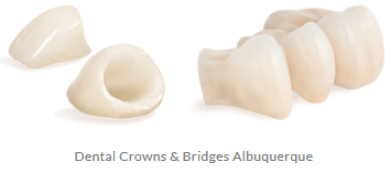 Crowns & Bridges, (512) 452 5713